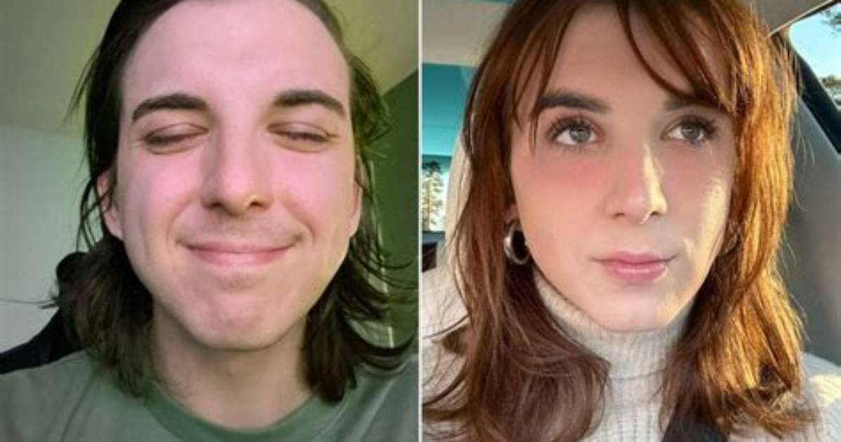 Is Chris Tyson Transgender? Before and After Plastic Surgery Photos
