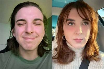 Is Chris Tyson Transgender? Before and After Plastic Surgery Photos