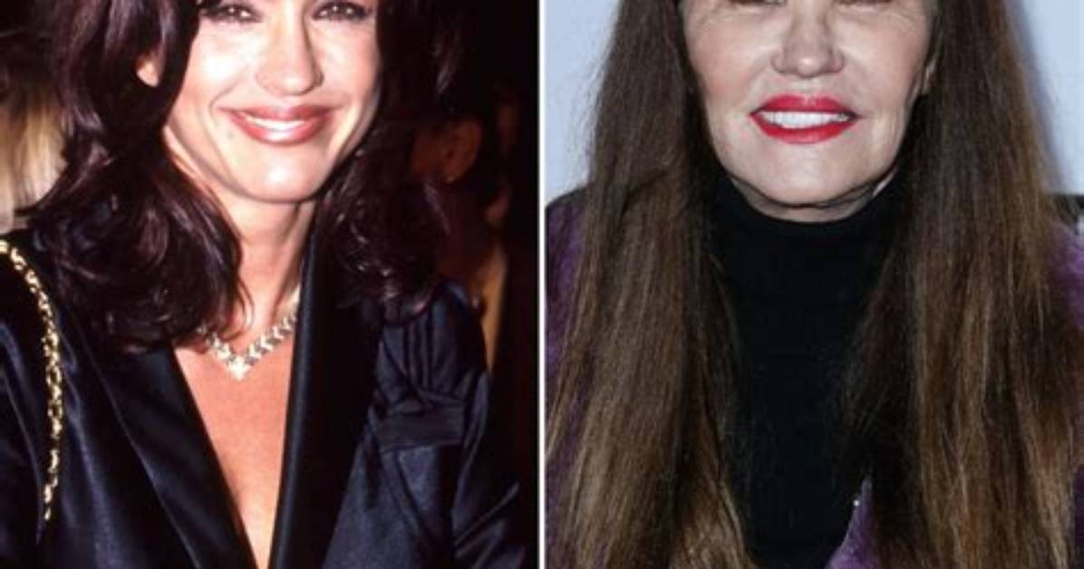 Janice Dickinson on Her Plastic Surgery: ‘I Don’t Think My Appearance Has Changed’