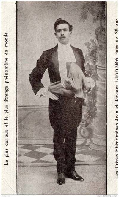 Jean Libbera Wikipedia Bio – Who Was He? X-Ray Photos and Age Details