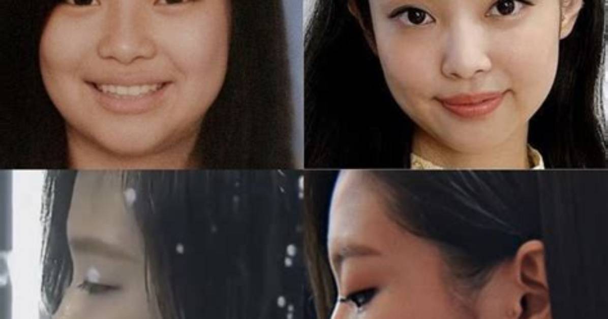 Jennie Kim Plastic Surgery: Did She Get Her Nose and Lips Done? Before and After Pics