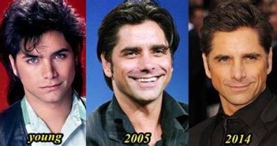 John Stamos Plastic Surgery, Before and After – Health Update and Age
