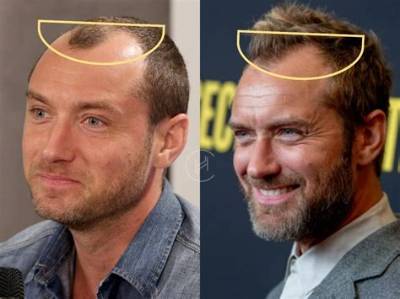 Jude Law Has More Hair in Latest Ad Campaign