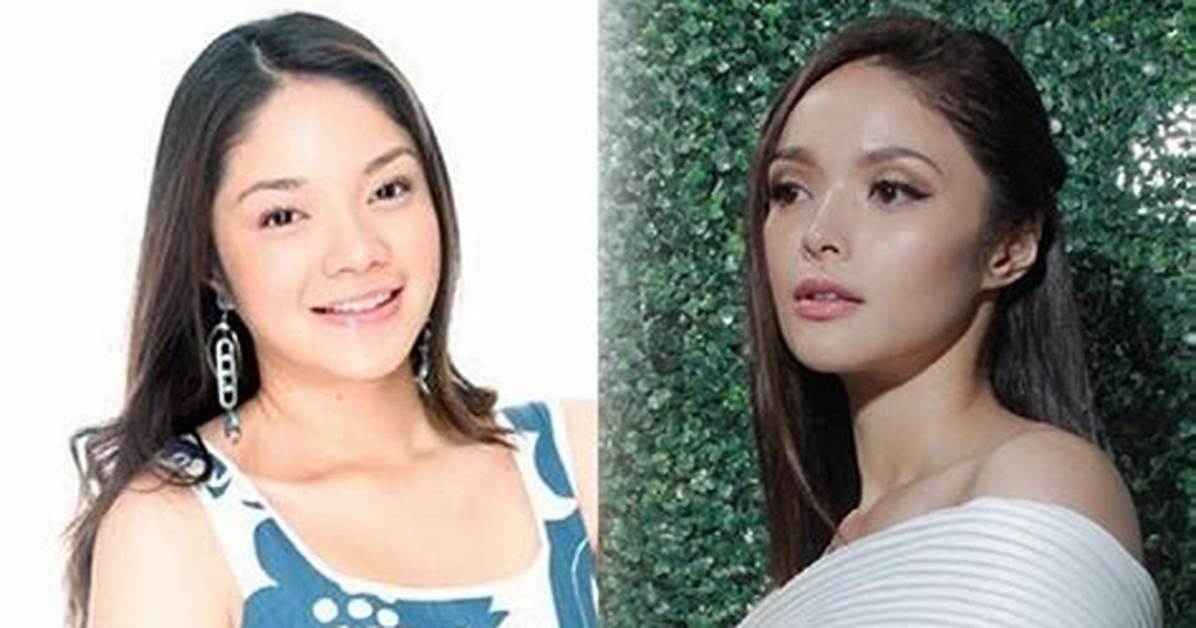 Kazel Kinouchi Before and After Plastic Surgery, Age Height and Instagram Explored