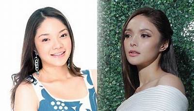 Kazel Kinouchi Before and After Plastic Surgery, Age Height and Instagram Explored