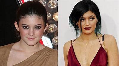 Kylie Jenner's Shocking Quarantine Transformation