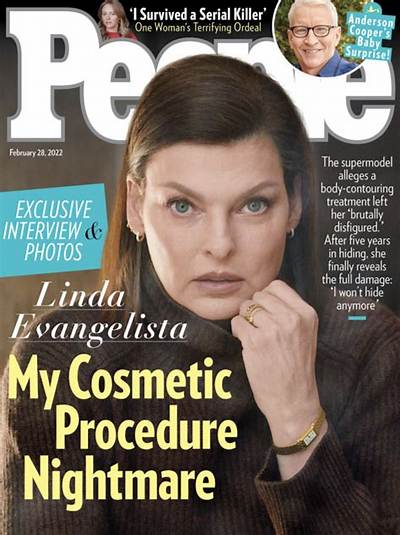 Linda Evangelista Covers People: ‘I Can’t Live Like This Anymore, in Hiding and Shame’