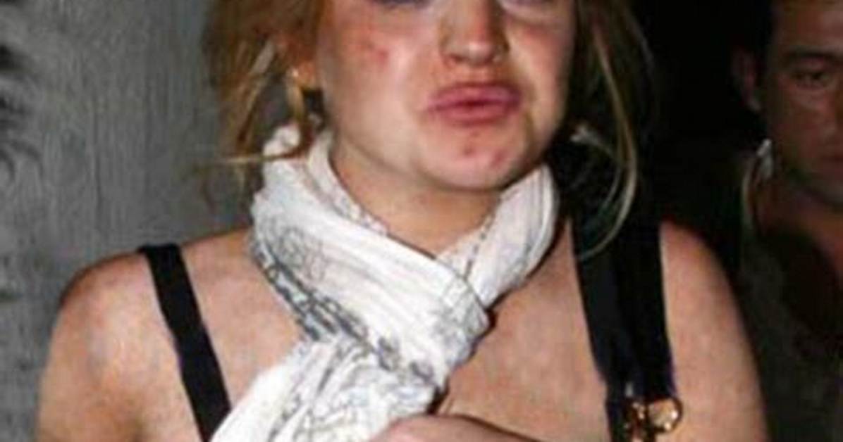 Lindsay Lohan Did Lines of Cocaine in Front of a Gossip Blogger in 2009