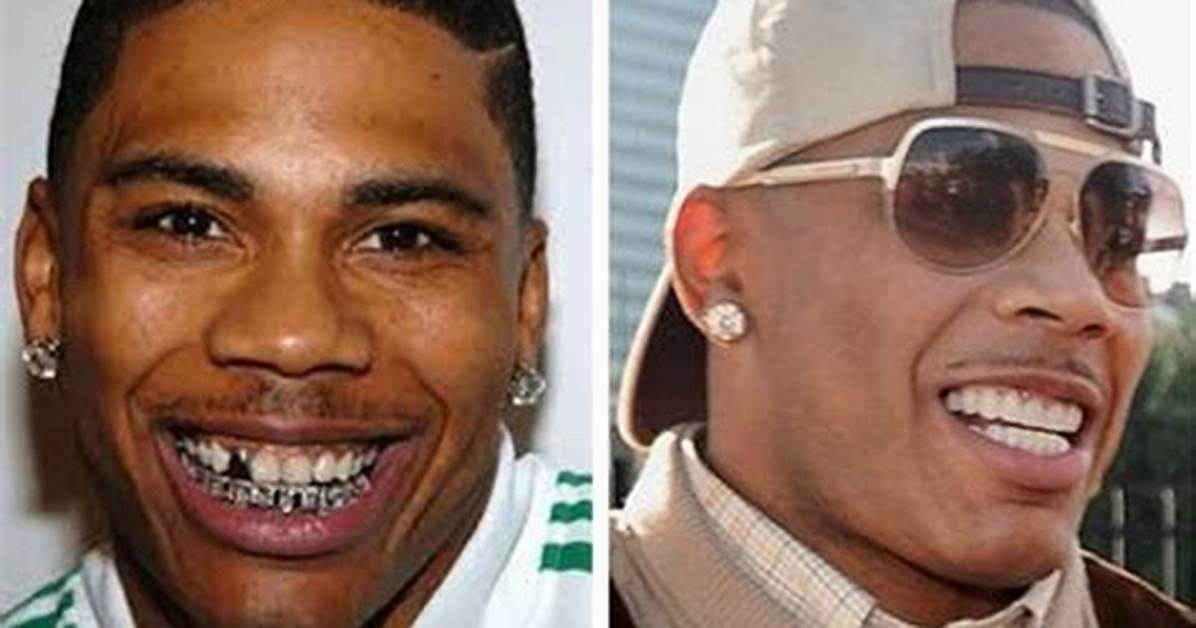 Nelly Lose Tooth, How Did Nelly Lose His Tooth?