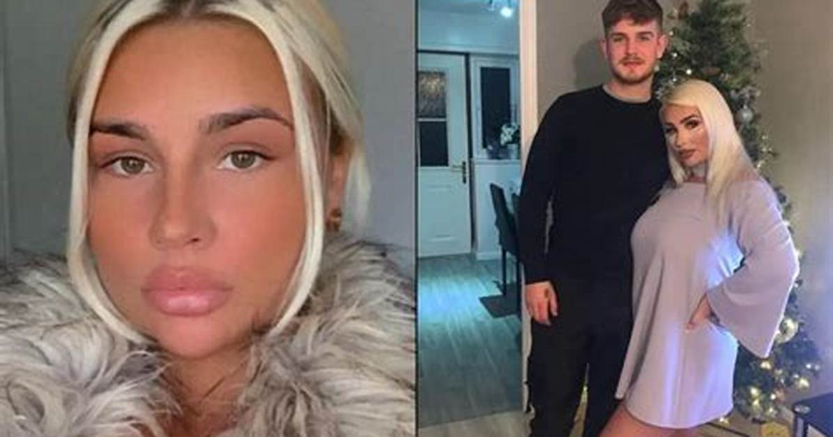 Onlyf Model, Abigail White, 24, Charged with the Murder of Her Boyfriend, Bradley Lewis, 22