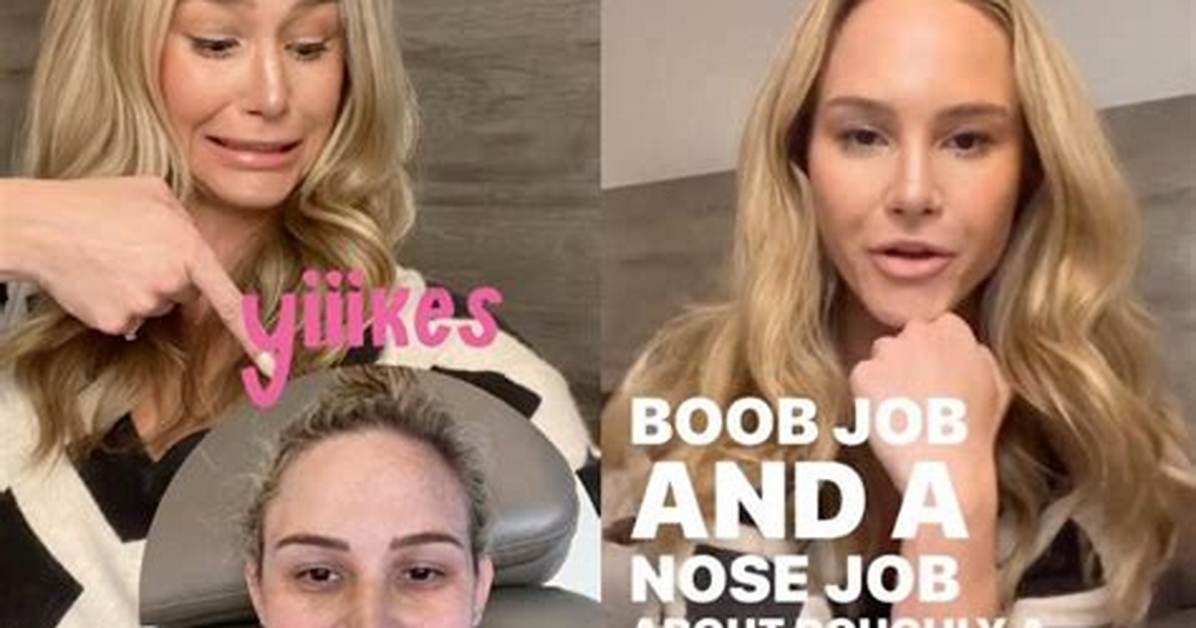 Rhoc’s Meghan King on Her Nose and Boob Jobs: Like a Natural, Enhanced Version