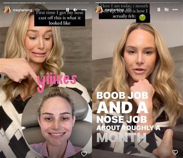 Rhoc’s Meghan King on Her Nose and Boob Jobs: Like a Natural, Enhanced Version