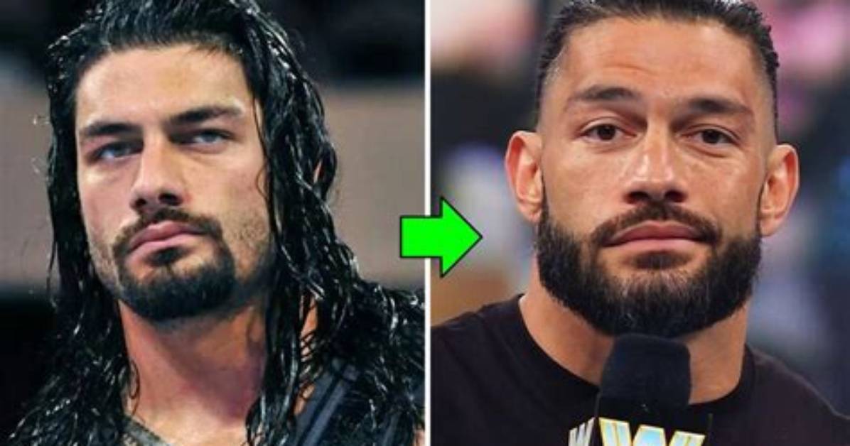 Roman Reigns Plastic Surgery: Roman Reigns Before and After Photos