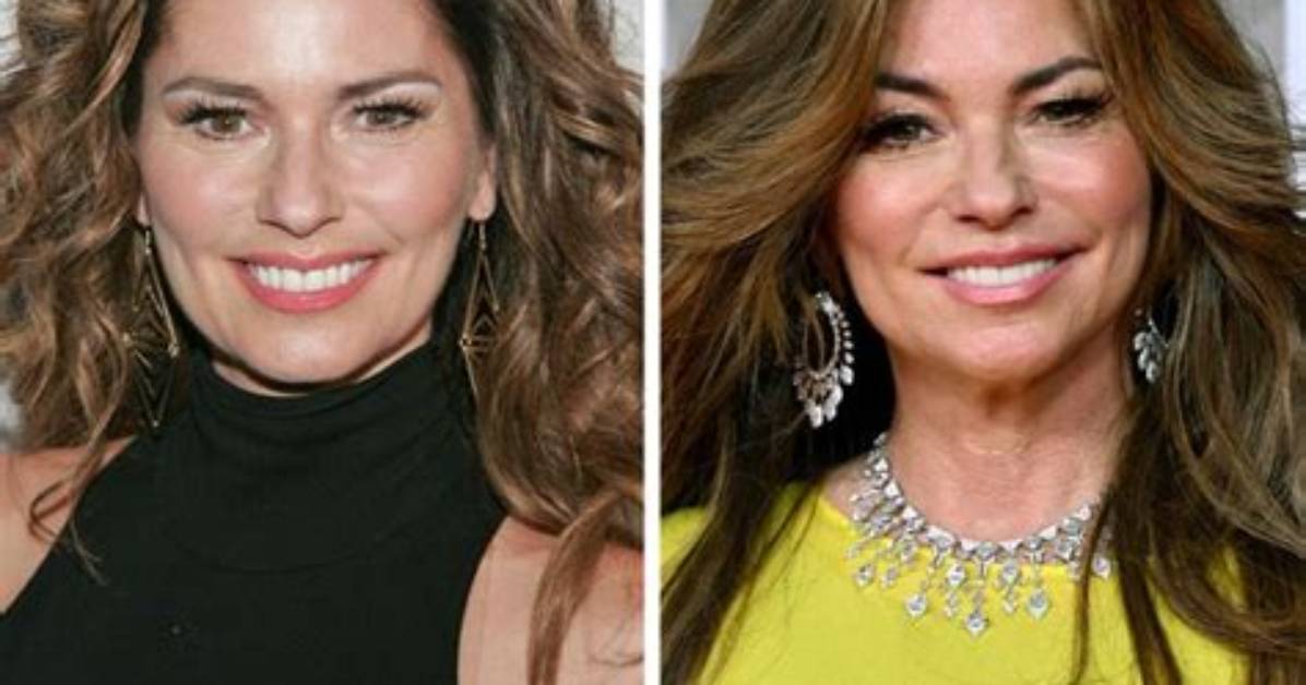 Shania Twain, to Change Her Look, Did the Singer Has Face and Multiple Throat Surgeries?