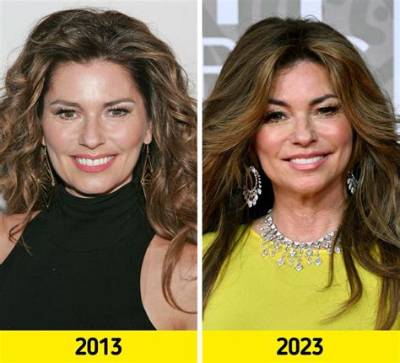 Shania Twain, to Change Her Look, Did the Singer Has Face and Multiple Throat Surgeries?