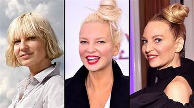 Sia Loves Her Plastic Surgery Results: ‘I Got an Amazing Face Lift’
