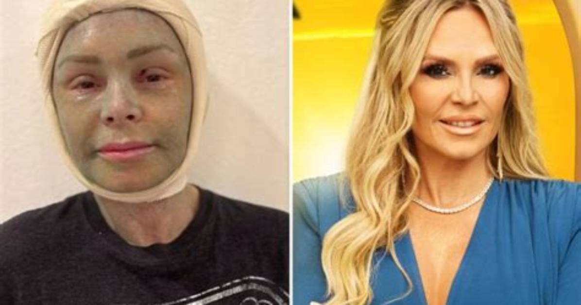 Tamra Judge Weight Loss Journey | Before and After Photo