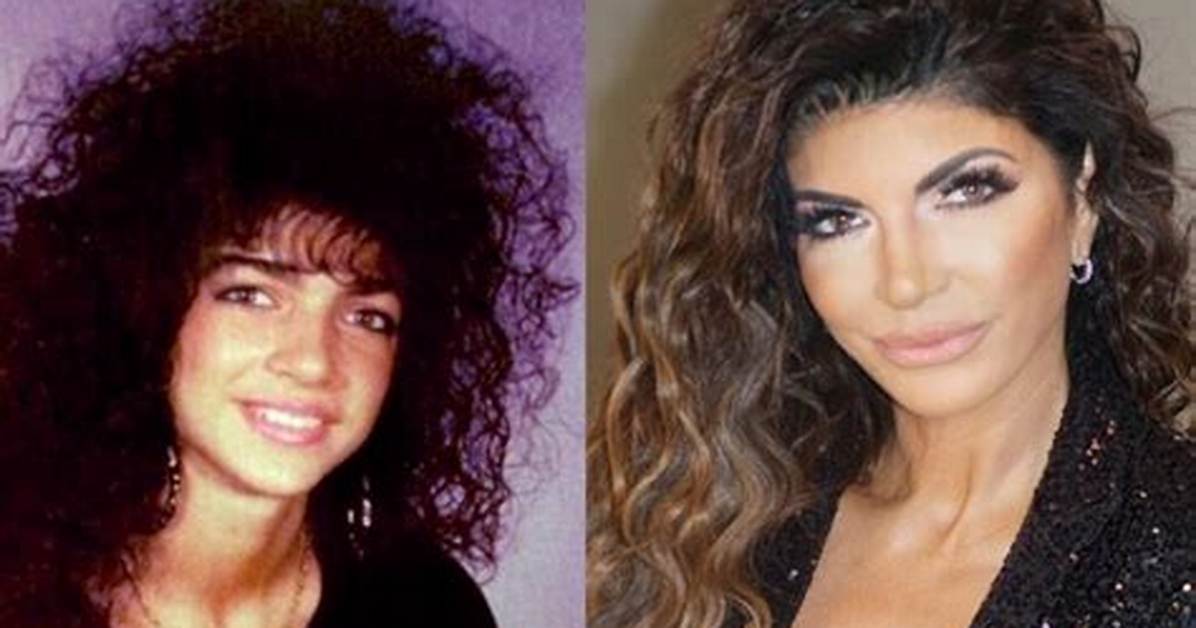 Teresa Giudice Nose Job, Plastic Surgery Before and After