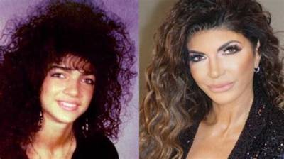 Teresa Giudice Nose Job, Plastic Surgery Before and After