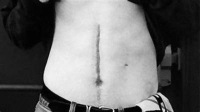 Terrifying Story Behind Keanu Reeves' Stomach Scar