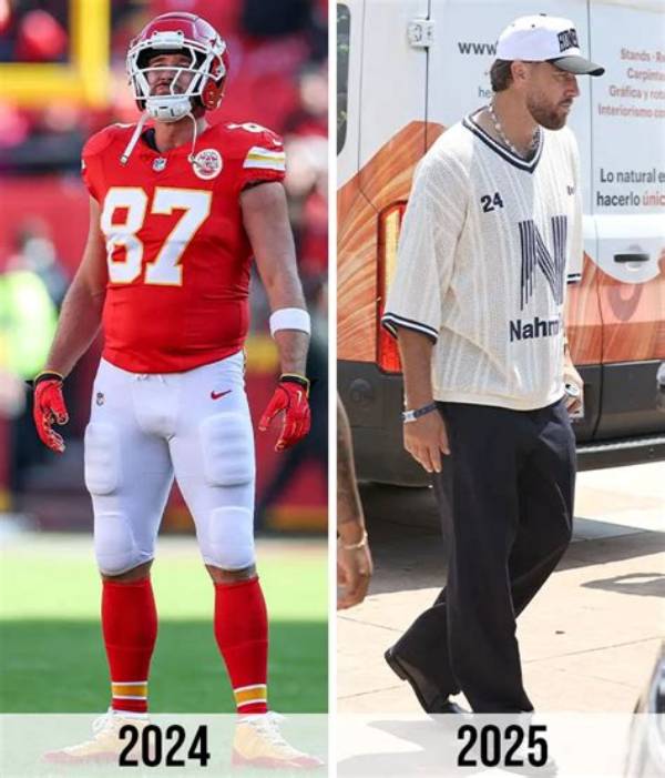 Travis Kelce | Weight Loss | Before and After
