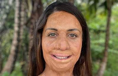 Turia Pitt Height, Weight, Net Worth, Age, Birthday, Wikipedia, Who, Nationality, Biography