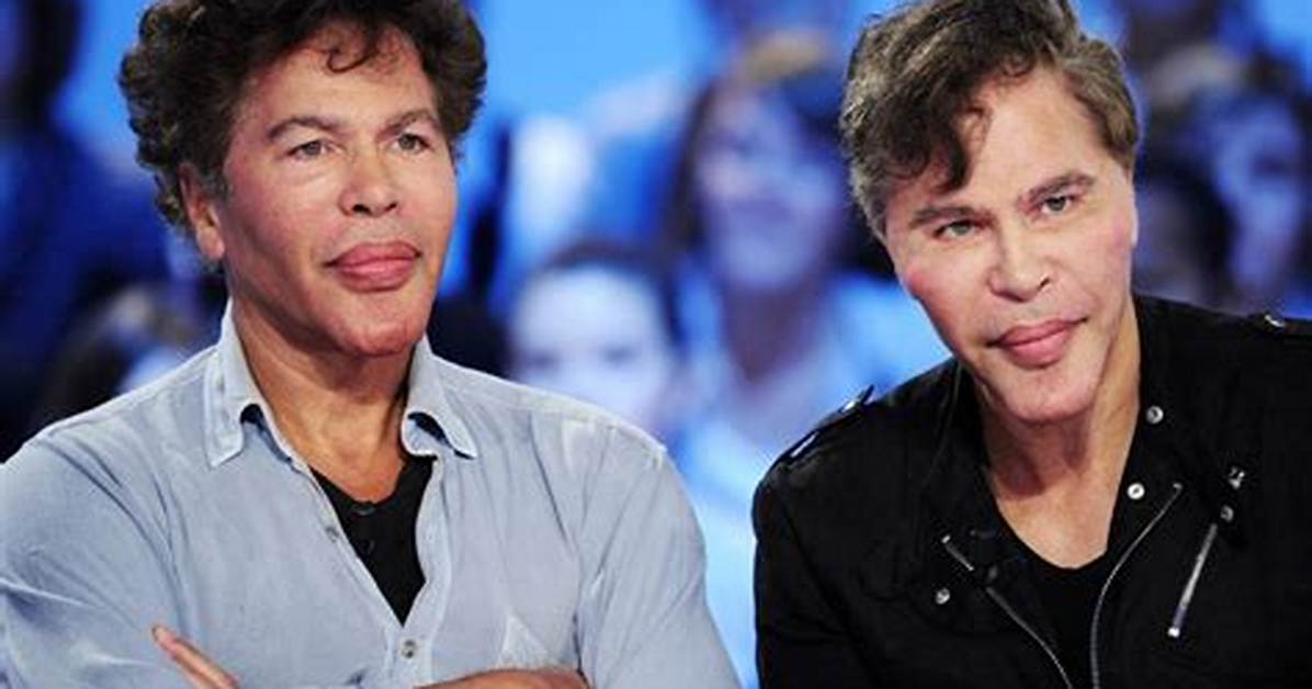 Twin French Tv Stars Get Matching Horrendous Plastic Surgery (Update)