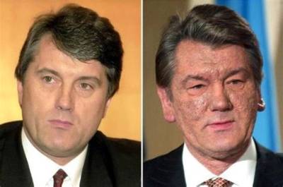 Viktor Yushchenko Face Before and After, Former President Was Poisoned by an Agent