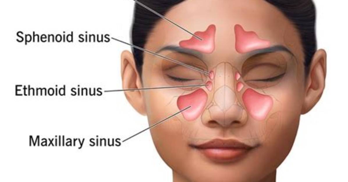 What Does It Mean If Paranasal Sinuses Are Aerated?