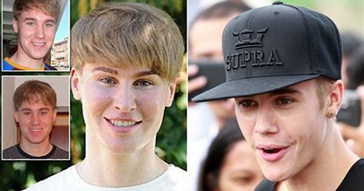 What Happened to Justin Bieber Lookalike Toby Sheldon from Botched?