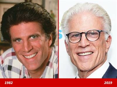 What Happened to Ted Danson Teeth: Has He Used Braced?