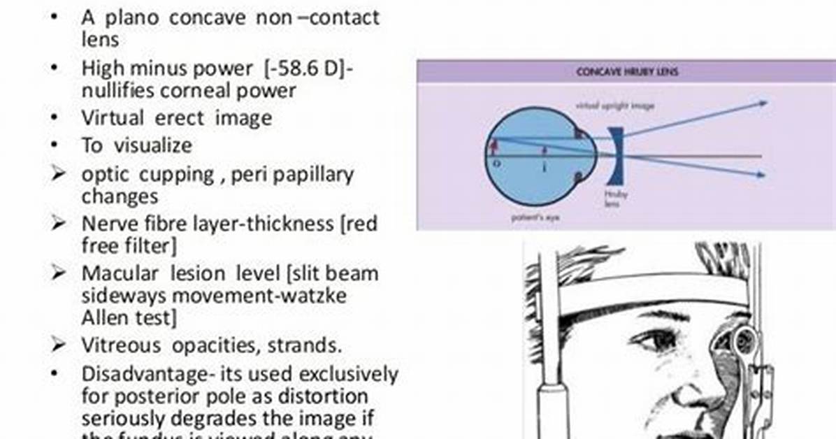 What Is Hruby Lens?