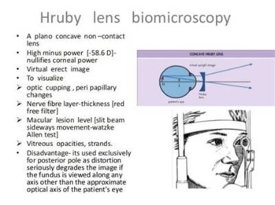 What Is Hruby Lens?