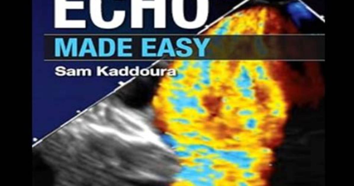 Who Is Echo Made by?