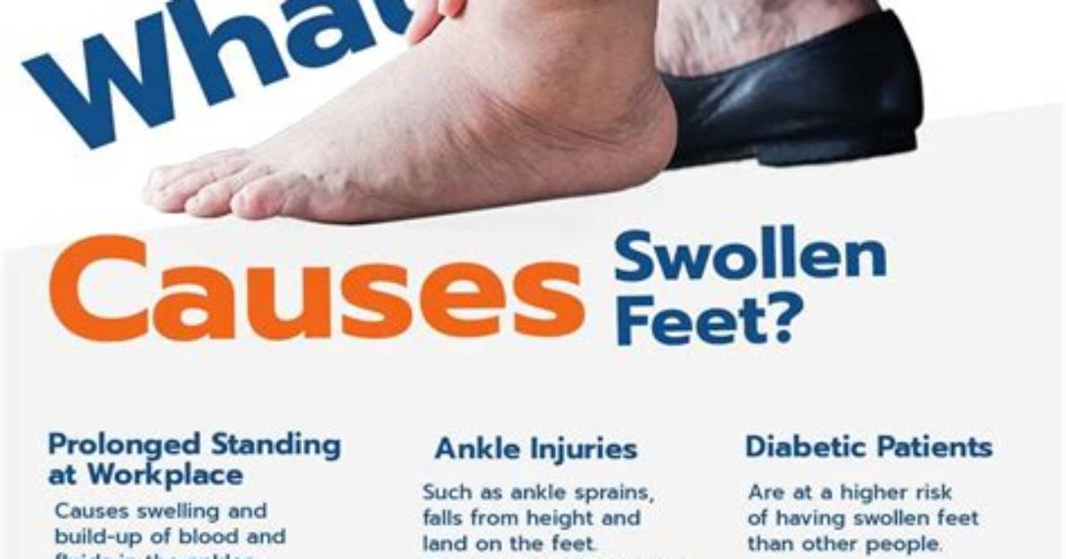Why Do My Feet Swell When I Drink?