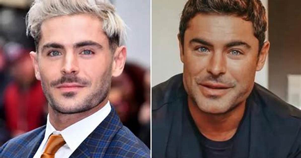Zac Efron Botox and Jaw Surgery Before and After Plastic Surgery