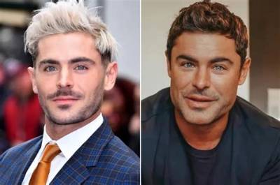 Zac Efron Botox and Jaw Surgery Before and After Plastic Surgery